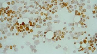 células marrones vistas por un microscopio