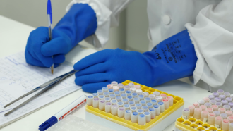 manos con guantes azules al lado de tubitos metido en gradillas