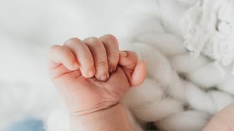 Mano congénita bebé mano con seis dedos