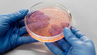Microbiología prueba