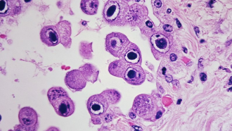 Citomegalovirus visto al microscopio