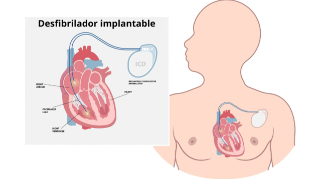 ilustración de cabeza y torso de hombre con corazón y un cable y un dispositivo