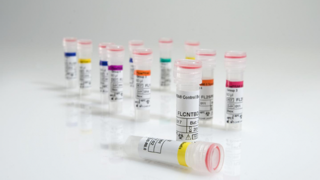 Anticuerpos Anti HLA prueba