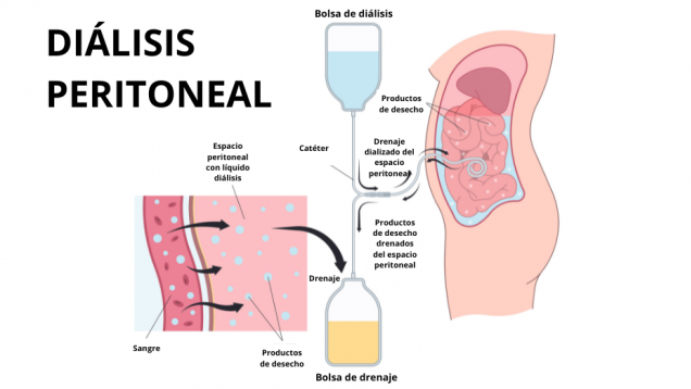 imagen prediseñada de cuerpo en lateral con órganos internos y dos líneas que salen del interior y que llevan a dos recipientes uno con líquido amarillo y otro azul